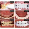 5 Days Teeth Whitening Toothpaste Remove Plaque Stains Powder Deep Cleaning - Image 3