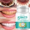 5 Days Teeth Whitening Toothpaste Remove Plaque Stains Powder Deep Cleaning - Image 5