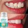 5 Days Teeth Whitening Toothpaste Remove Plaque Stains Powder Deep Cleaning - Image 6